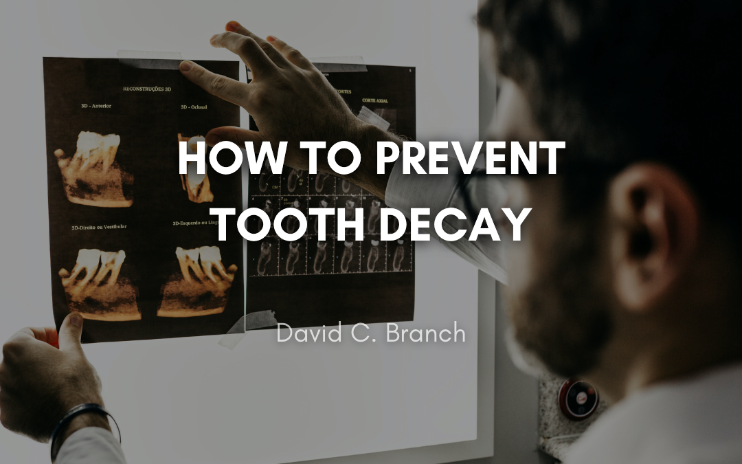 How to Prevent Tooth Decay